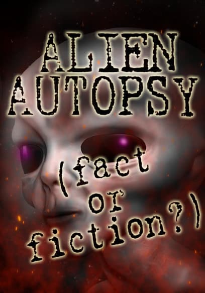 Alien Autopsy