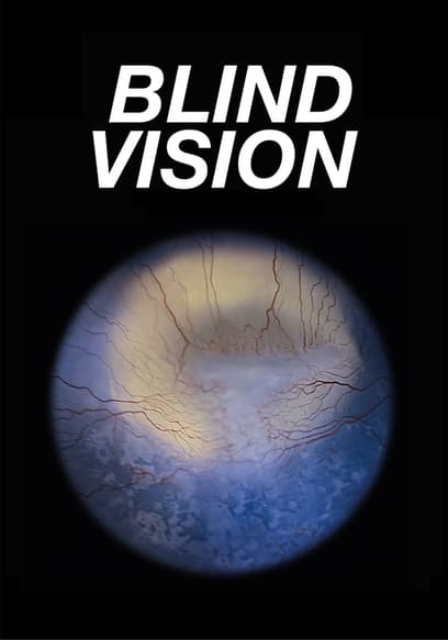 Blind Vision