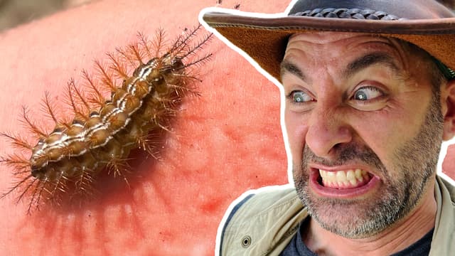 Brave Wilderness: Bites & Stings