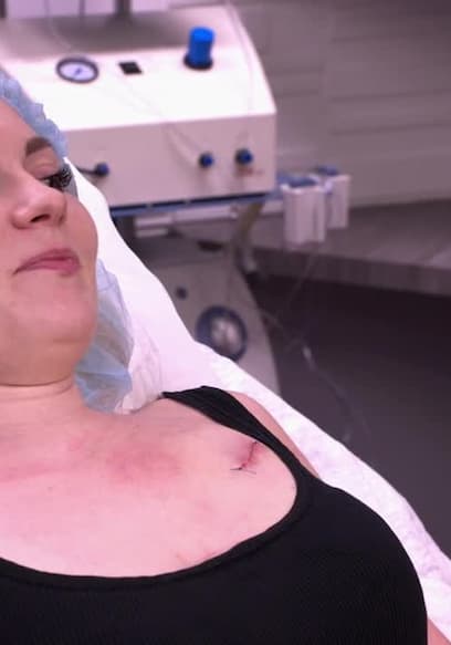 S01:E03 - This Cyst Persists poster