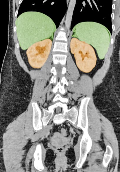 S01:E02 - A Student Felt A Sharp Pain In Her Side. This Is How Her Organs Shut Down. poster
