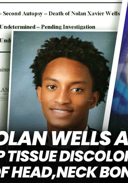 S01:E66 - Nolan Wells Autopsy: Deep Tissue Discoloration Back of Head, Neck Bone Missing poster