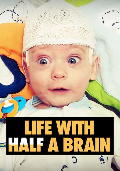 Life with Half a Brain