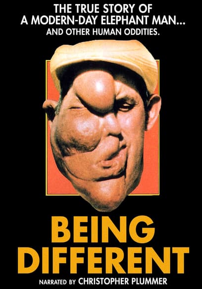 Being Different