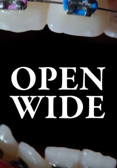 Open Wide