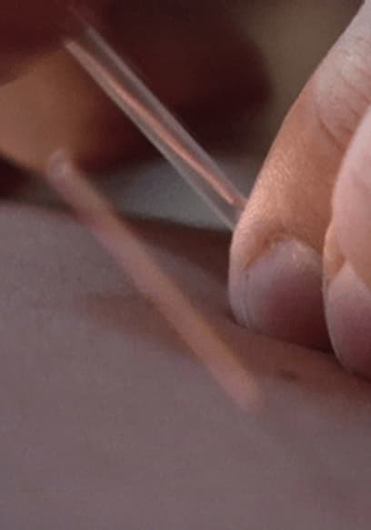 S01:E03 - Acupuncture and Herbs poster