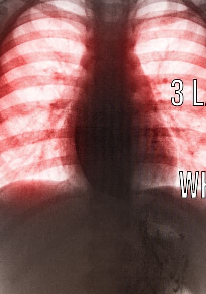 S01:E08 - A Boy Ate 3 Laundry Pods. This Is What Happened To His Lungs. poster