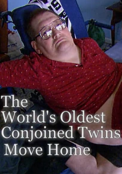 World's Oldest Conjoined Twins Move Home