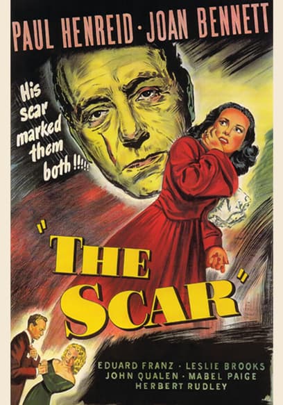 The Scar