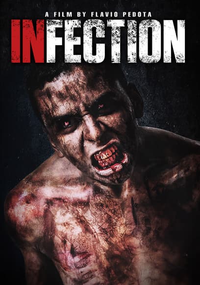 Infection