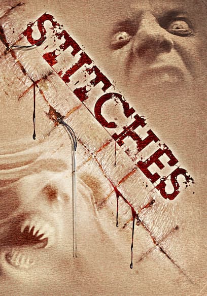 Stitches
