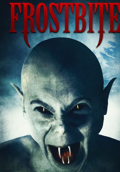 Frostbite
