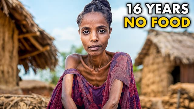 S02:E10 - She Hasn't Eaten in 16 Years (Doctors Confirmed)