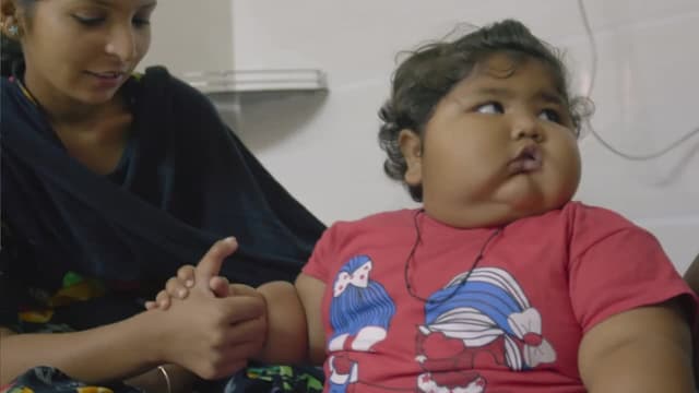 S07:E05 - My 44-Pound Baby