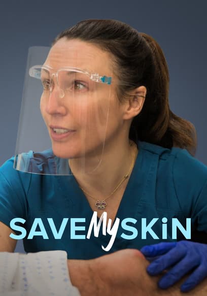 S01:E04 - Cease and De-Cyst