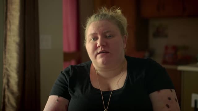 S06:E01 - My Arm Won't Stop Burning Me!