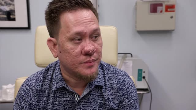 Watch Dr. Pimple Popper S03:E101 - This Is Zit - Free TV Shows | Tubi