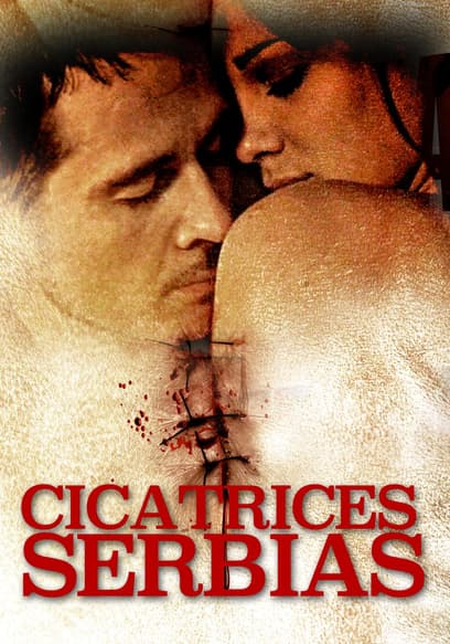 Cicatrices serbias (Doblado)