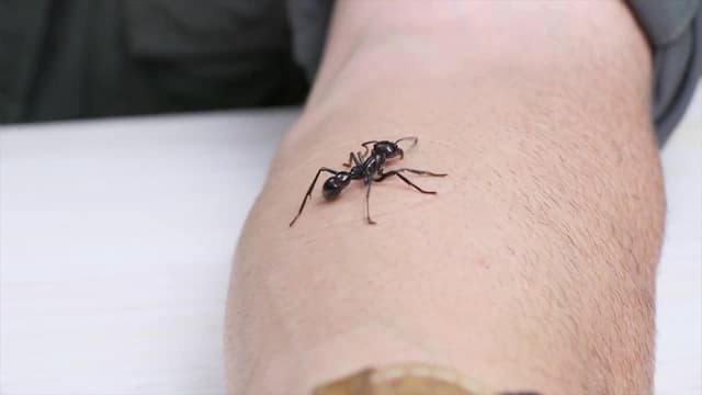 S03:E02 - Stung by a Bullet Ant!