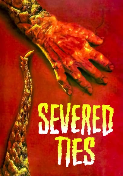 Severed Ties