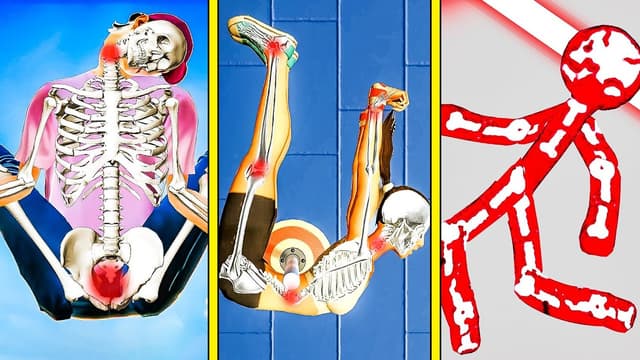 S24:E01 - Best Bone Breaking Games