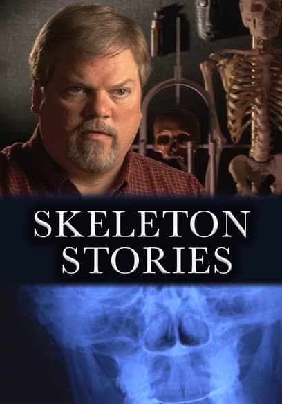 Skeleton Stories