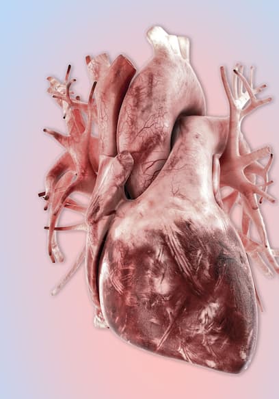 S01:E04 - A Starving Mom Ate 40 Cookies. This Is What Happened To Her Heart. poster
