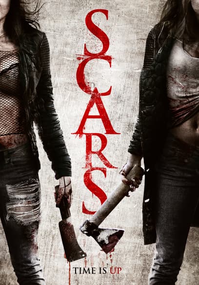 Scars
