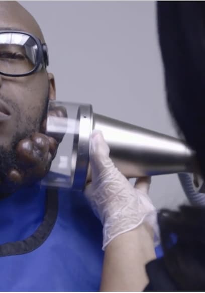 S01:E12 - Round Two of Corrective Surgery poster