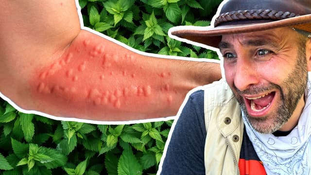 Brave Wilderness: Bites & Stings
