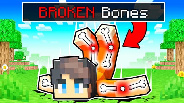 S01:E20 - Broken Bones Prank