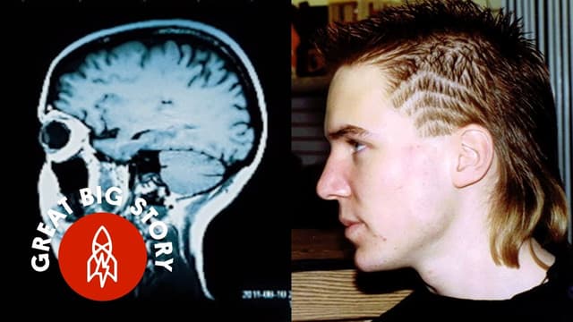 S01:E18 - Accidental Genius