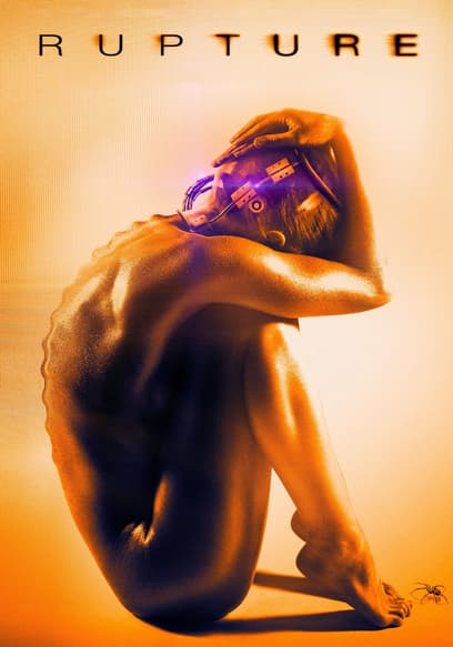 Rupture