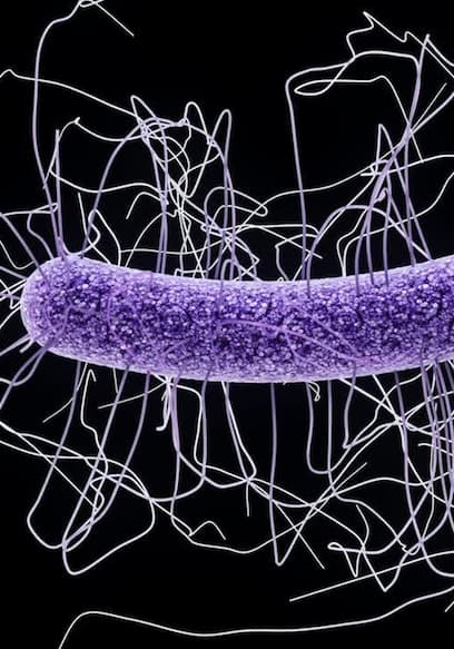S01:E04 - GERM WARFARE: Fighting the Super Bugs. poster