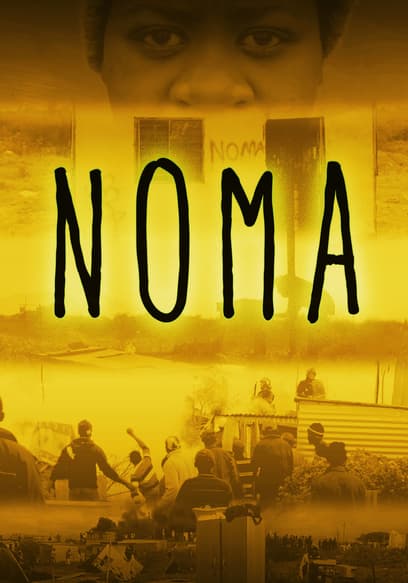 Noma