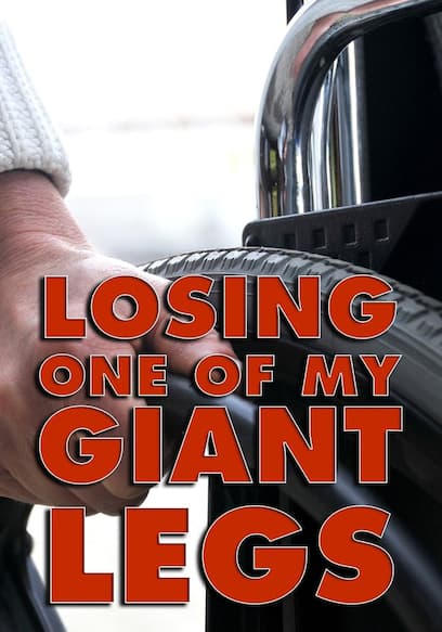 Losing One of My Giant Legs