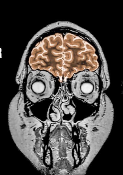 S01:E01 - A Mom Drank 3 Gallons Of Water In 2 Hours. This Is What Happened To Her Brain. poster