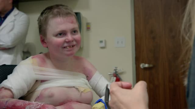 S05:E01 - My Skin Is Falling Off