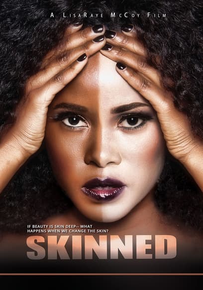 Skinned