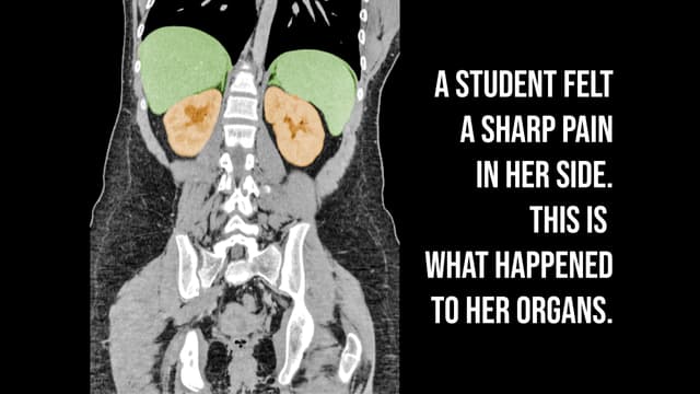 S01:E02 - A Student Felt A Sharp Pain In Her Side. This Is How Her Organs Shut Down.