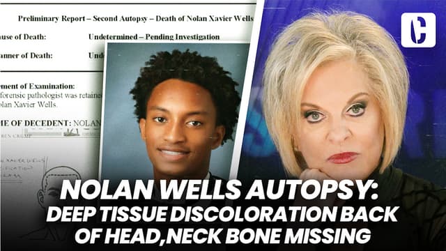 S01:E66 - Nolan Wells Autopsy: Deep Tissue Discoloration Back of Head, Neck Bone Missing