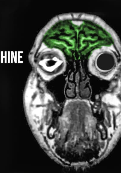 S01:E07 - A Man Drank 2 Liters Moonshine In 2 Hours. This Is What Happened To His Eyes. poster