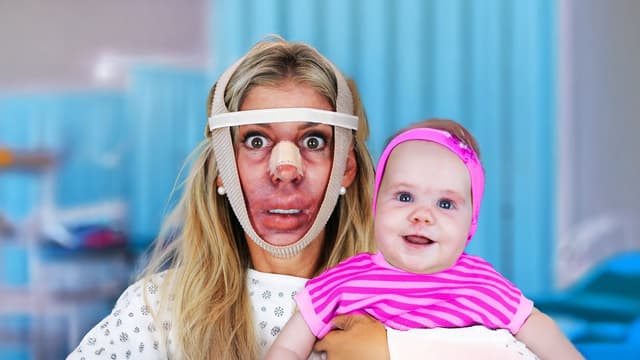 S02:E04 - I Got Plastic Surgery to Twin My Baby