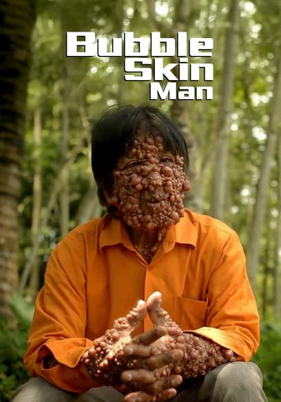 Bubble Skin Man