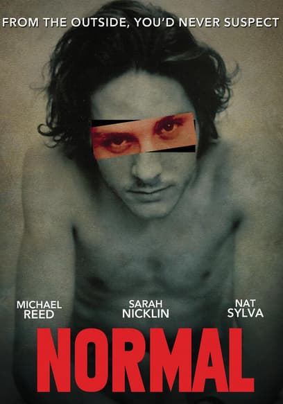 Normal